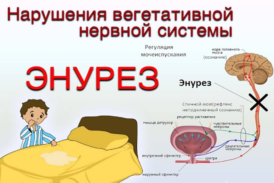 Энурез