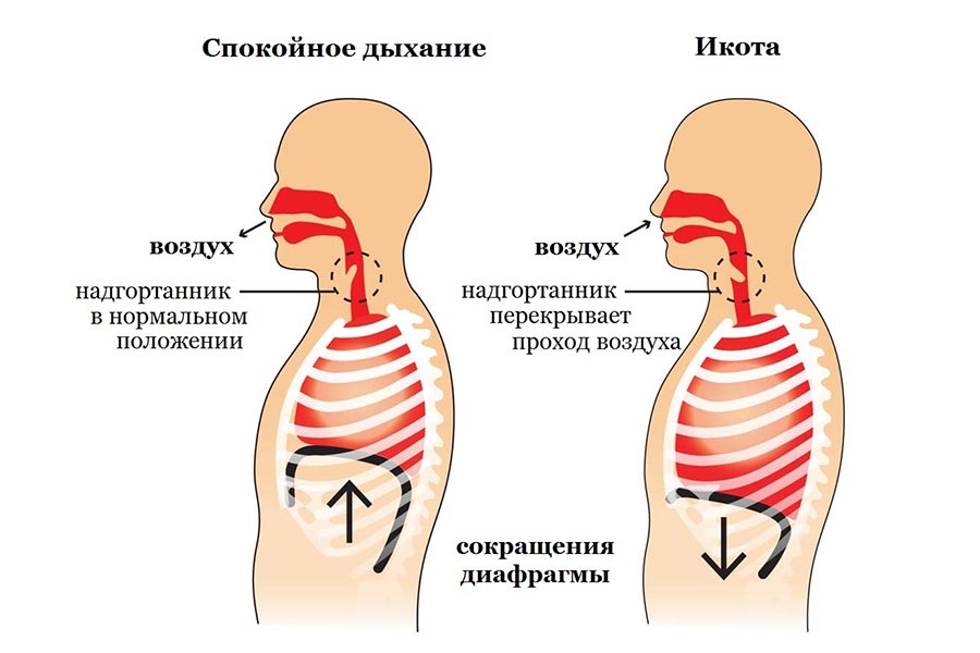 Причины икоты у детей