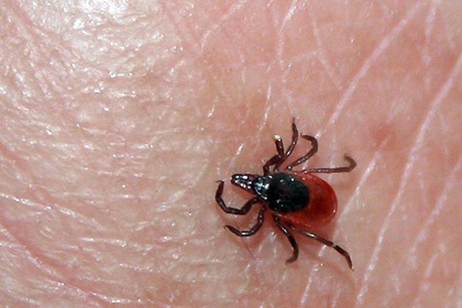 Клещевой энцефалит