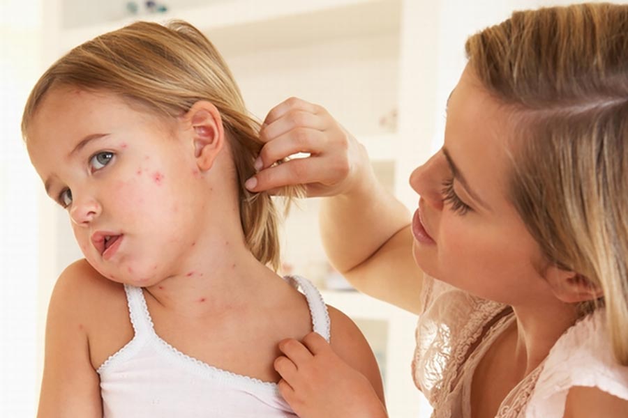 Корь у ребенка