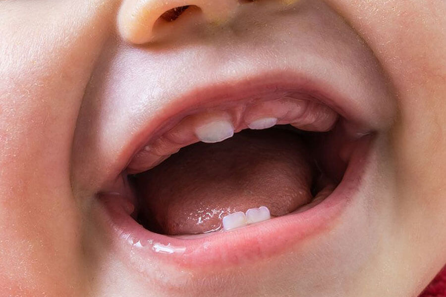 Прорезывание первых зубов