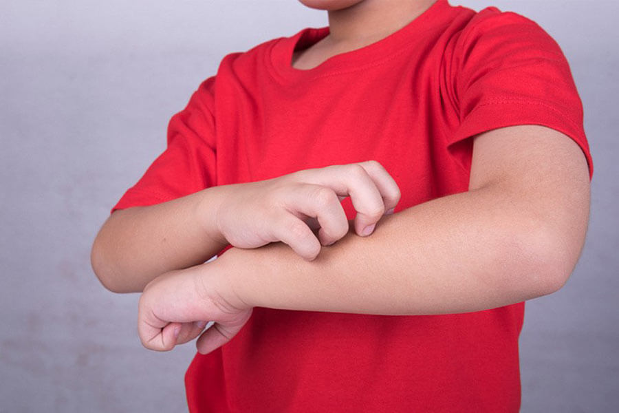 Потливость и зуд у ребенка