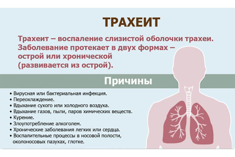 Причины трахеита у детей