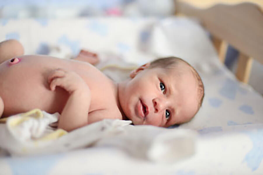 Пупочная грыжа у ребенка