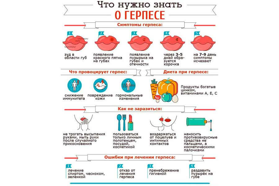 Симптомы герпеса