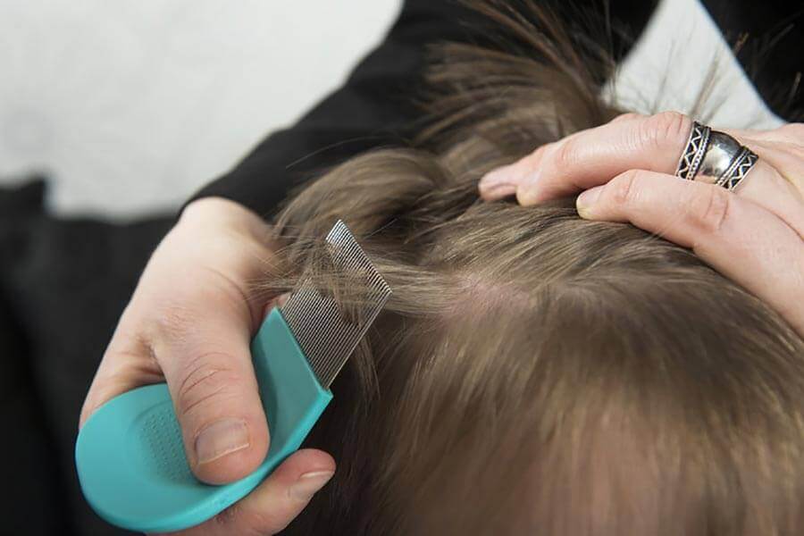 Вши у ребенка