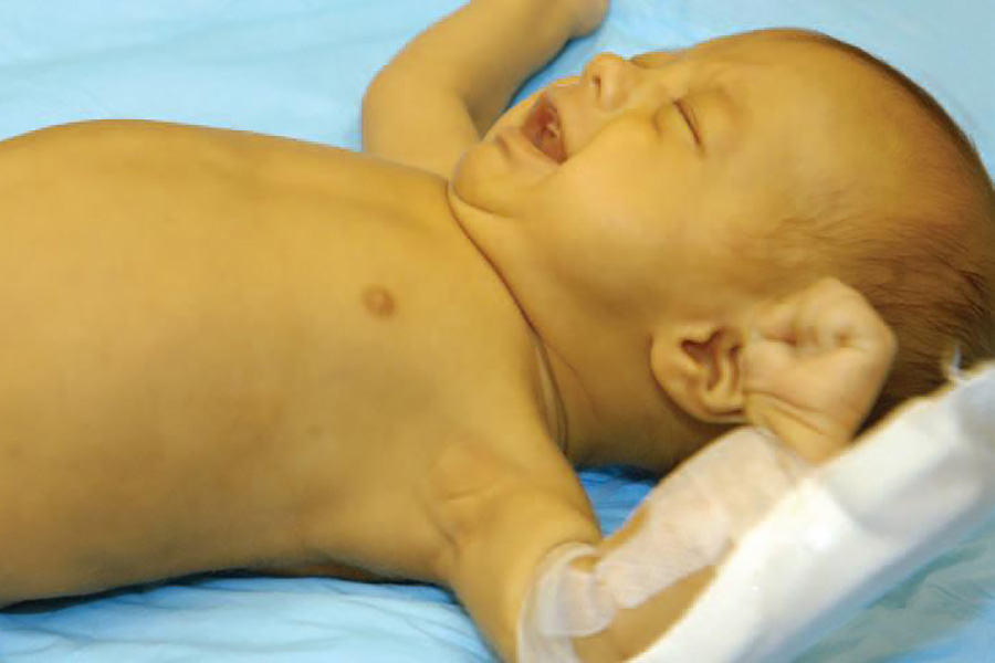 Желтуха у ребенка